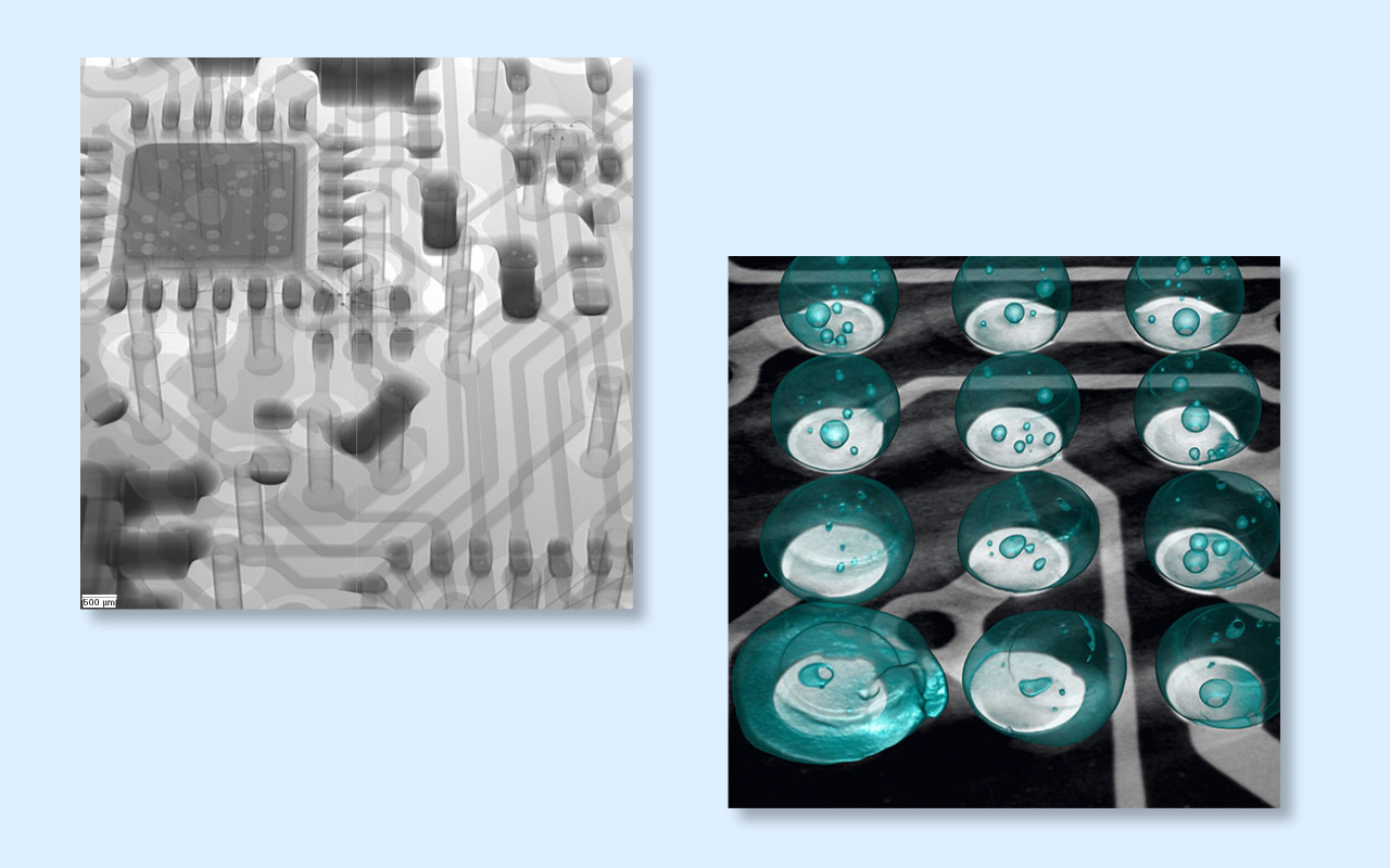 4. 2D vs 3D CT X-ray Which One Do You Really Need? 4. الأشعة المقطعية ثنائية الأبعاد مقابل ثلاثية الأبعاد، أيهما تحتاج حقًا؟