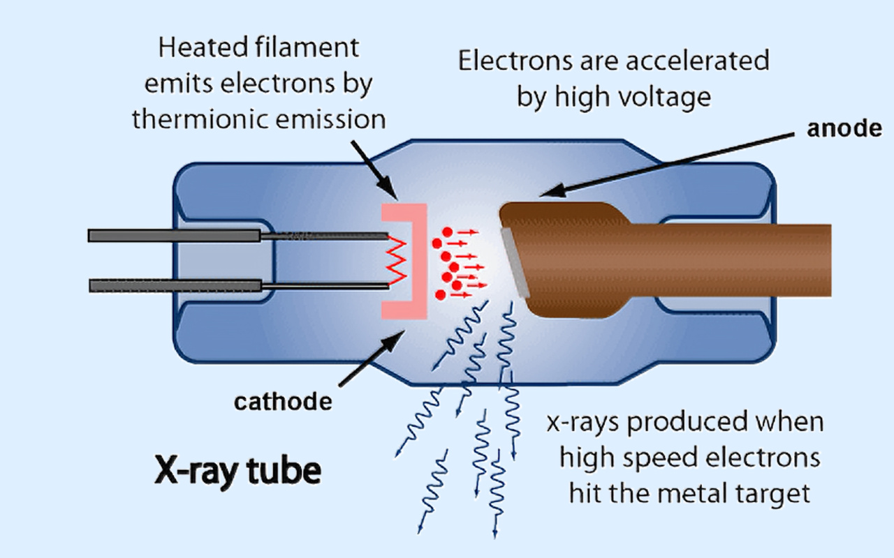 2. What X-ray Technology Actually Does 2. ما الذي تفعله تقنية الأشعة السينية فعليًا؟